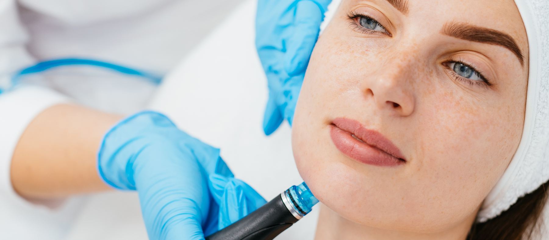 HydraFacial treatment being carried out with the treatment handpiece on a client's cheek
