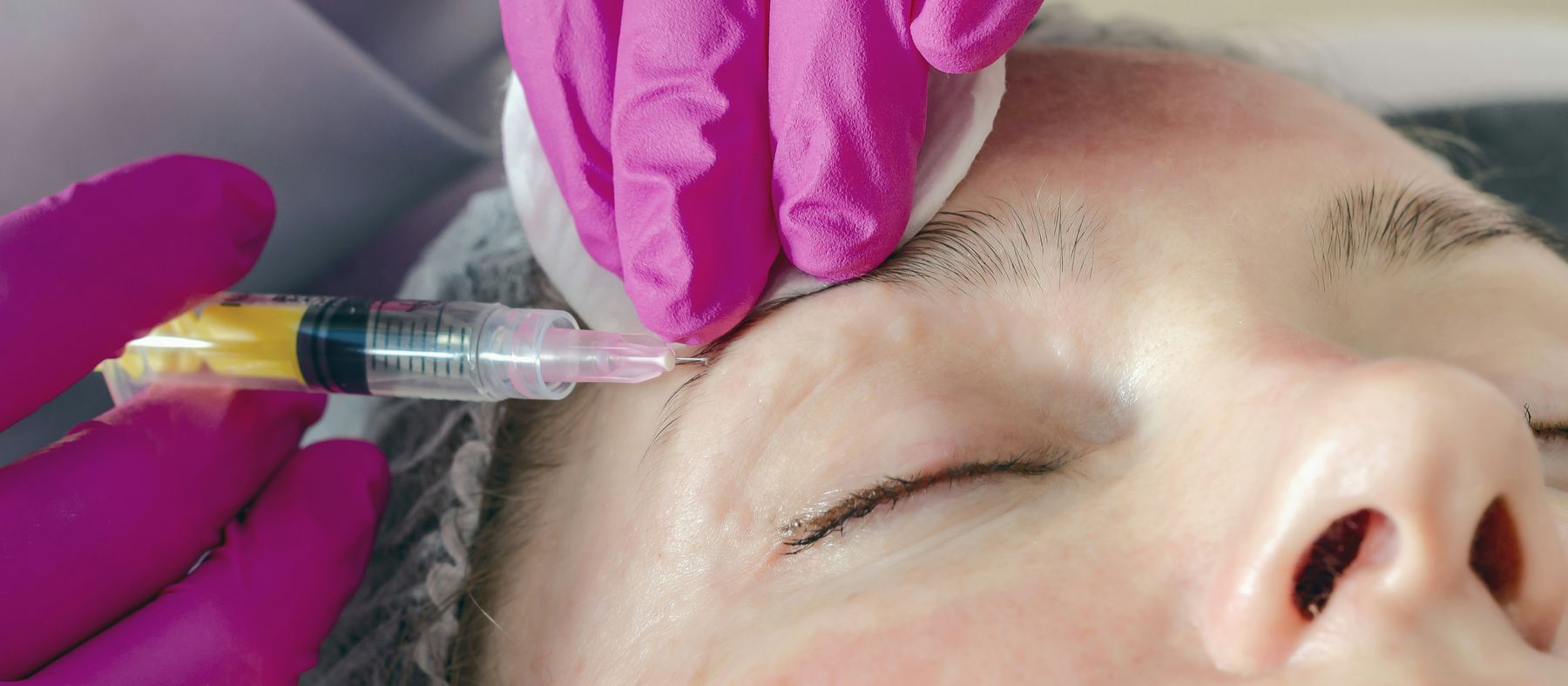 PRP platelet rich plasma being injected during a regenerative treatment